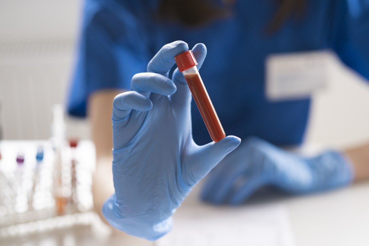 "To talk about herd immunity, 60 or 70% of the population has to be reached"