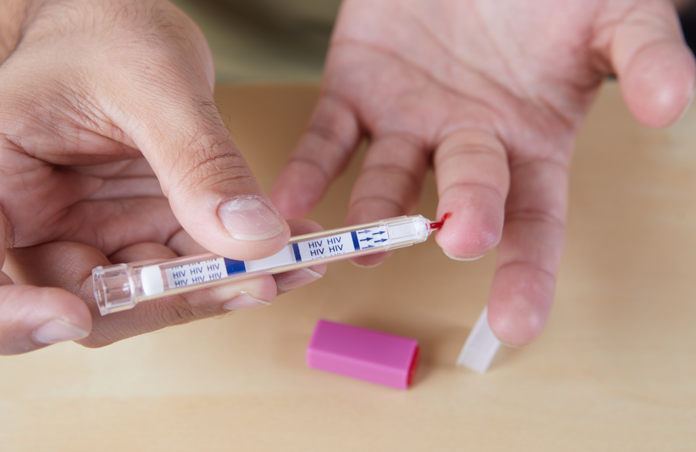 Minsa reports 287 new HIV cases in the first half of 2020