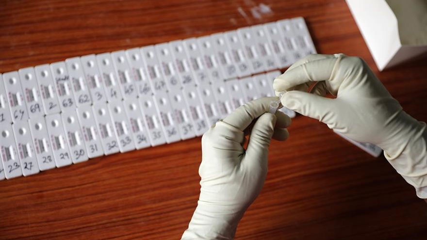 Pruebas de coronavirus