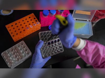 Sucre aclaró que aún no se pueden confirmar como nuevos casos de variante brasileña de COVID-19, están en estudio