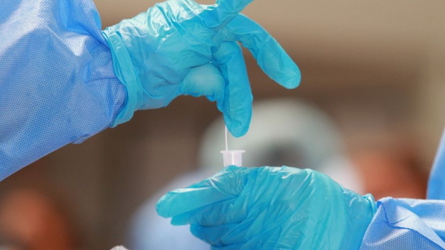 Se aplicaron en las últimas horas 9,733 pruebas para detectar coronavirus