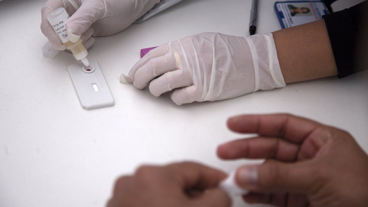 Panama among the countries most affected by HIV / AIDS in the region despite a decrease in cases