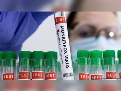 Monkeypox cases sweeping Latin America; none confirmed in USVI