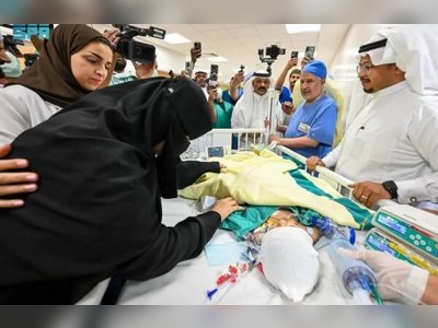 Saudi conjoined twins successfully separated in complex 12.5-hour surgery