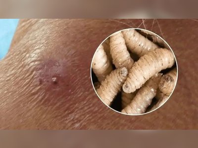 Costa Rica Confirms 56 Cases of Human Screwworm Infection