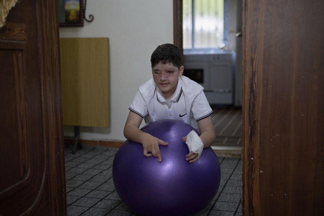 Portraits of Hezbollah Attack Survivors Capture Pain and Resilience