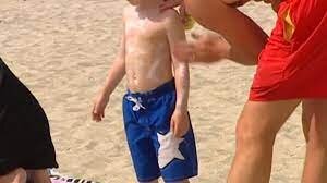 Australia Confronts Sunscreen Scandal Amid Skin Cancer Crisis
