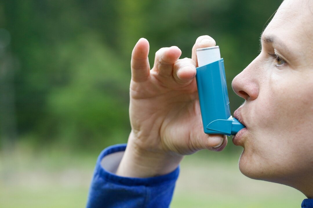 Italian Doctors Continue Reliance on Oral Corticosteroids for Asthma Care