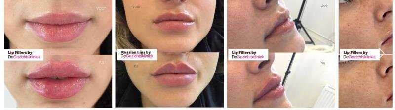 De Gezichtskliniek Expands at Amsterdam RAI with New Treatments