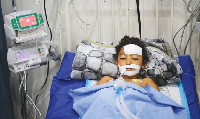 Gaza's Rubble Yields Deadly Toy: Twin Children Wounded by Unexploded Ordnance