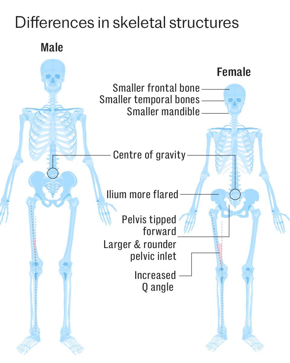 When Truth Is Criminalised: Swiss man jailed after stating skeletons are biologically male or female