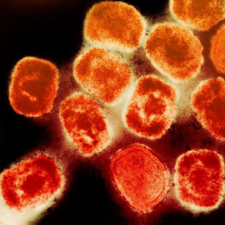 UK Identifies Newly Evolved Mpox Variant After Traveller Tests Positive