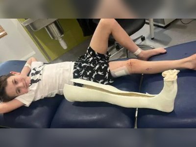 Nine-Year-Old Becomes First Child in UK to Undergo Groundbreaking Leg-Lengthening Surgery