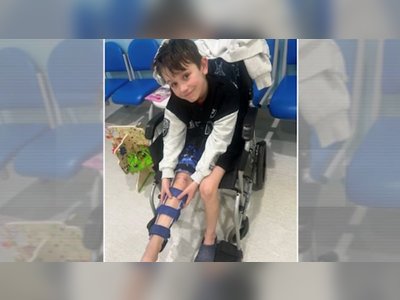 Nine-Year-Old Becomes First Child in UK to Undergo Groundbreaking Leg-Lengthening Surgery