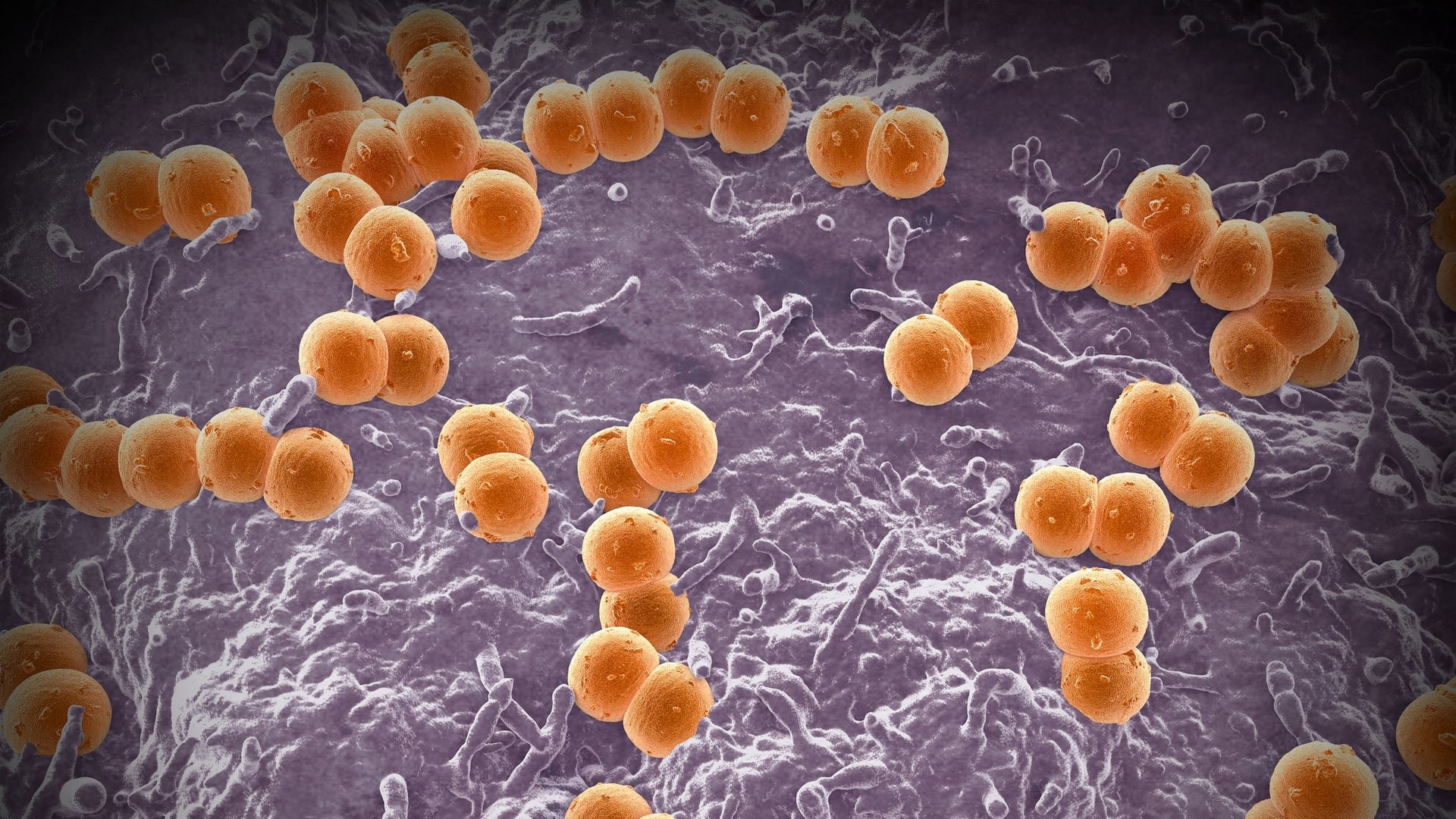 Deadly Meningitis Outbreak in the U.K. Highlights Urgent Need for Vaccination