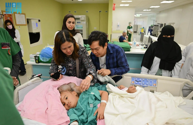 KSrelief Commences Groundbreaking Conjoined Twin Separation Surgery