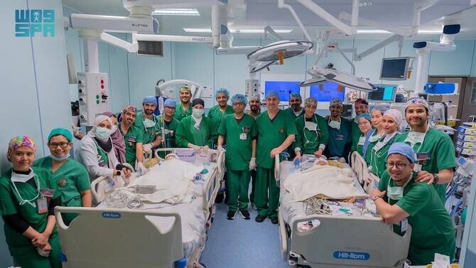 Filipino Conjoined Twins Receive Life-Changing Surgery in Riyadh