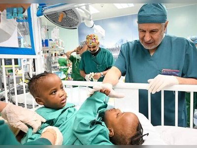 Separation of Tanzanian Conjoined Twins Begins in Riyadh