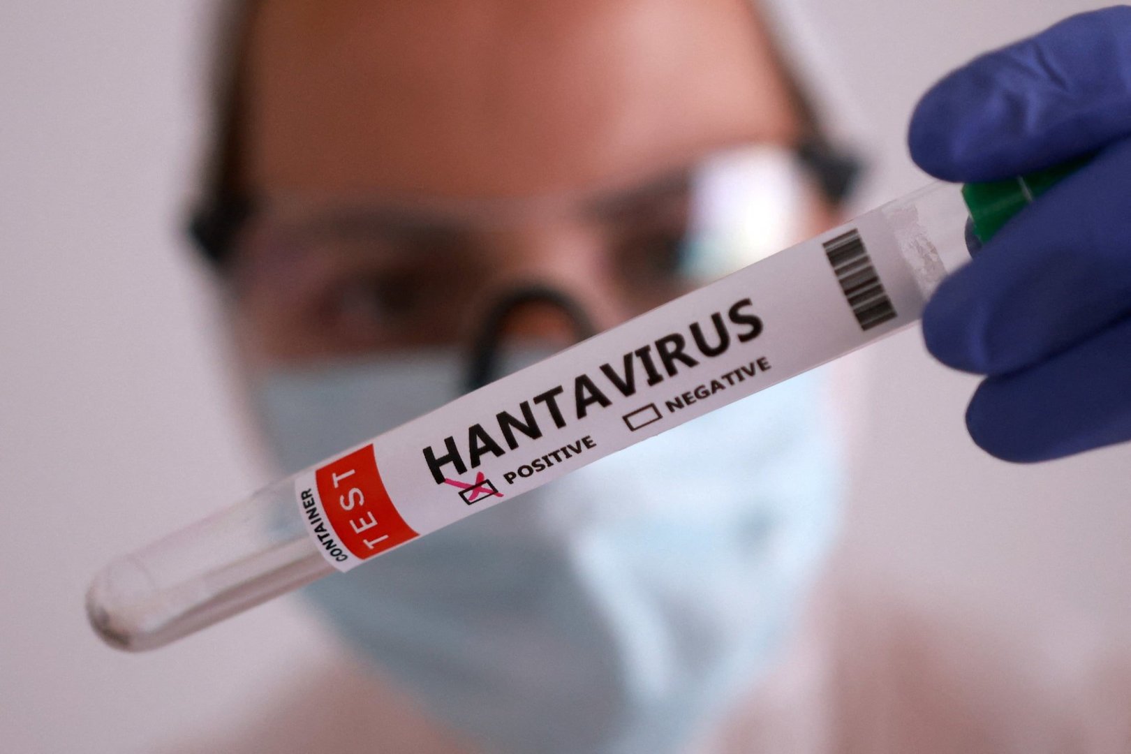 UK Confirms Third Suspected Hantavirus Case Linked to Cruise Ship Outbreak
